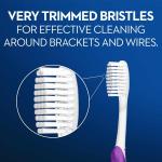 Oral-B Pro-Expert Ortho Orthodontic 35 Soft Manual Toothbrush, Assorted Colors